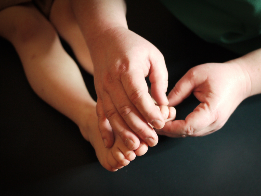 Adult hands hold the digits of a child's foot, against a dark background. A paediatric foot examination is taking place.