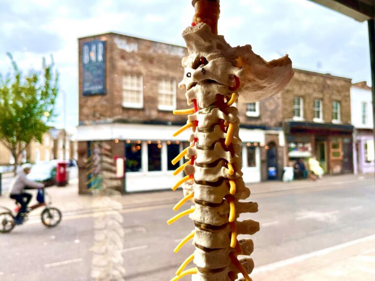 Spine vibrant scaled 1